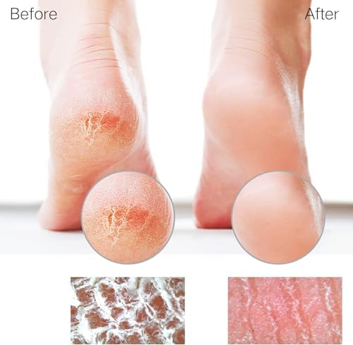 Glass Foot File Callus Remover for Feet, Heel Scraper, Pumice Stone