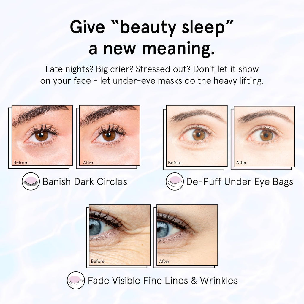 grace & stella Retinol Under Eye Patches for Puffy Eyes & Dark Circles