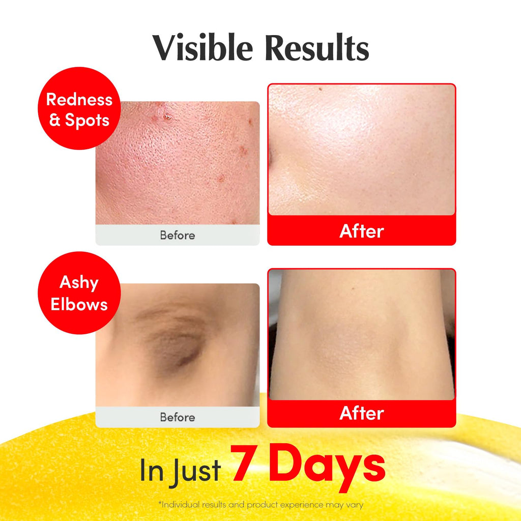 EQQUALBERRY Vitamin Illuminating Serum