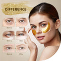 Taimand Under Eye Patches